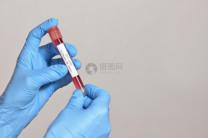 冠状病毒2019年NCOV血试验阳性图片