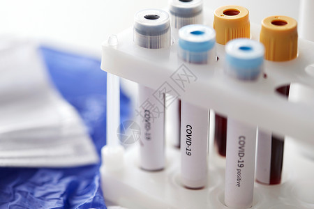 sars医学,医疗大流行烧杯与冠状病血液测试持有人实验室接受冠状病血液测试的烧杯背景