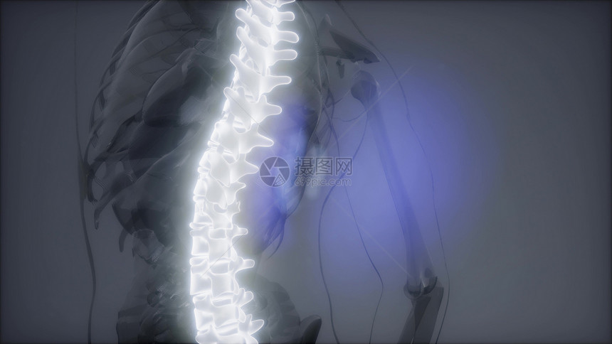 脊骨背痛人体脊柱骨骼发光的科学解剖扫描背部骨头背痛图片