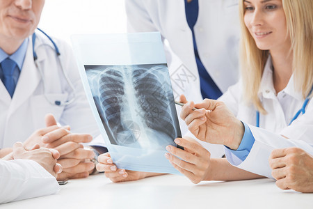 群医生诊所或医院里看并讨论胸部X光群医生讨论X光图片