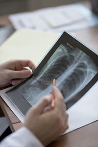 医生医疗办公室着胸部肺部X光的手图片