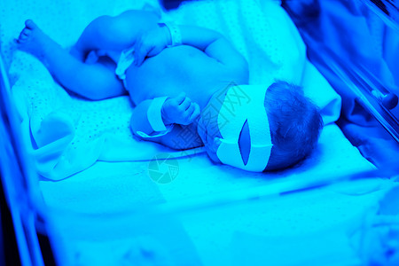 胆红素两天大的新生婴儿蓝色紫外线下拍照背景