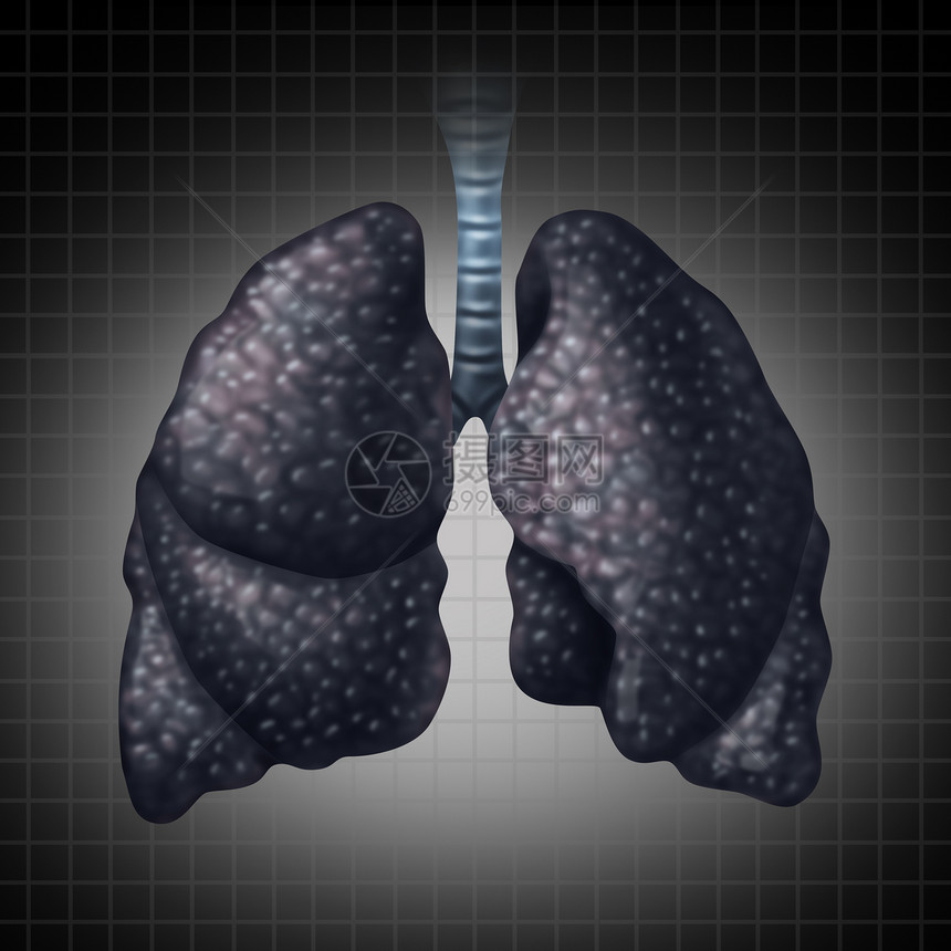 人类肺部疾病保健指由癌症疾病引的呼吸功能下降,如黑肺受损器官慢慢丧失功能图片