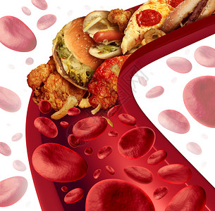 心血管堵塞胆固醇阻断了动脉的医学,人体血管被健康的食物堵塞,如汉堡包油炸食品,健康风险的隐喻,节食营养问题如饮食脂肪背景