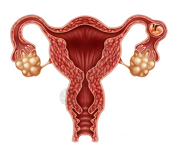 异位妊娠输卵管妊娠并发症医学妇产科种植入输卵管的人胚胎,三维插图元素图片