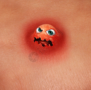 粉刺怪物痤疮格人类皮肤科皮肤健康的与三维插图元素图片
