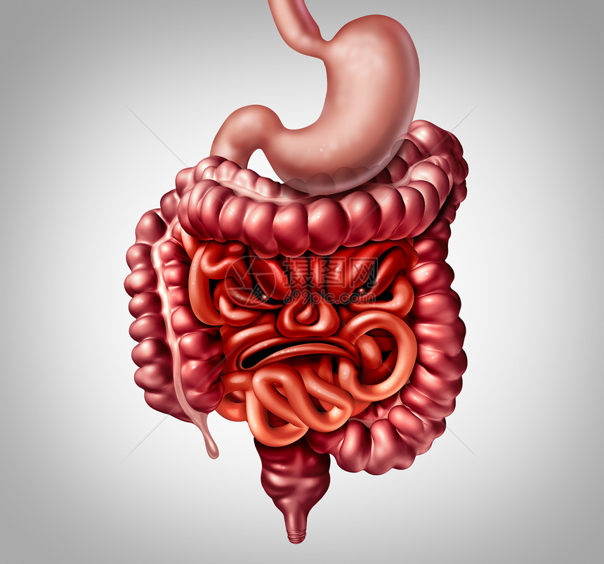 肠易激综合征的诊断症状的肠结肠炎症疼痛,如肠形状为愤怒的脸与三维插图元素图片
