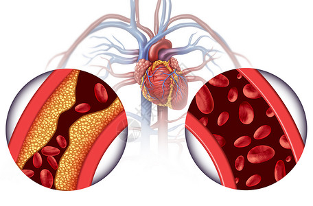 静脉产业园治疗心脏病血液循环疾病设计图片