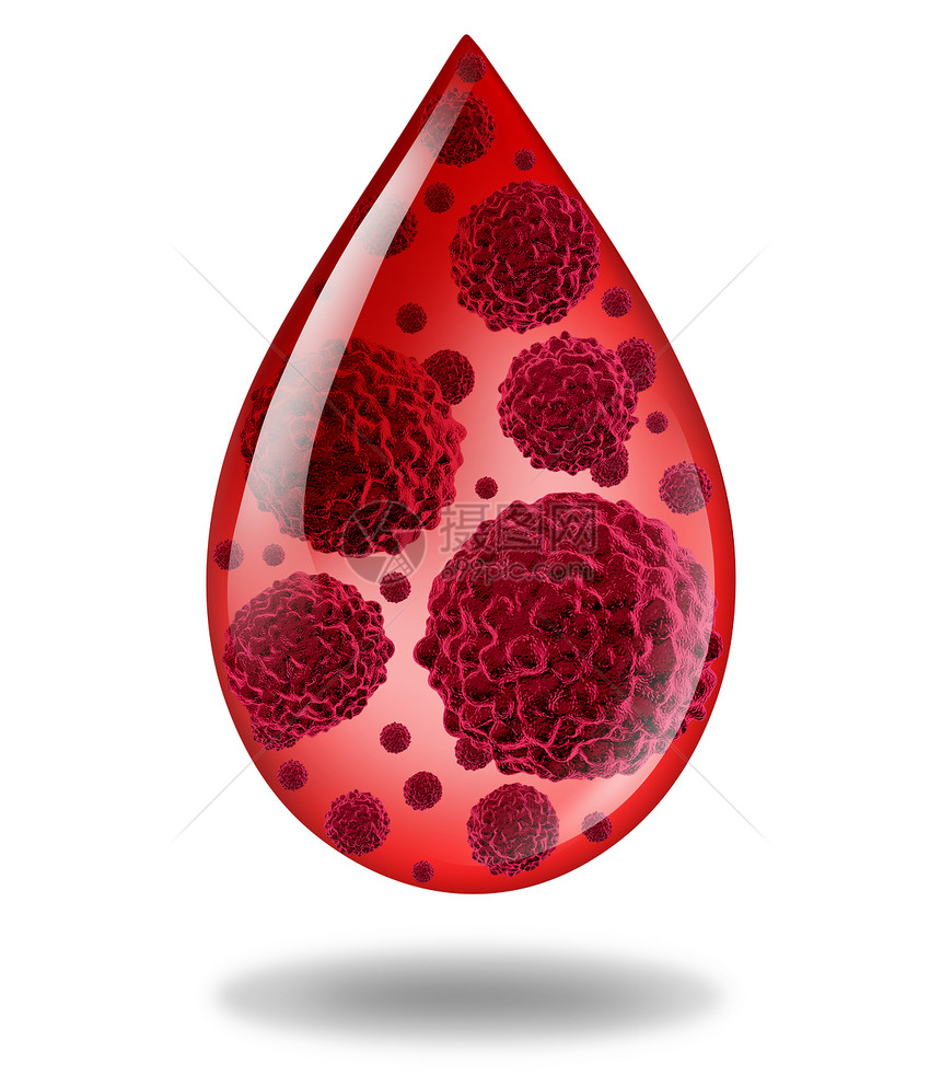 血癌白血病血液病的医学,人类疾病的三维插图淋巴瘤,血液癌症图片