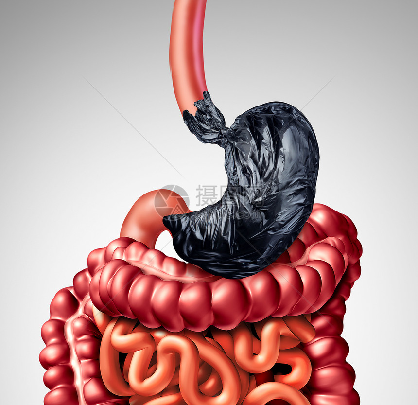人类消化问题个胃,形状为垃圾袋,肠道器官消化系统消化良疼痛的象征,医学上的例子人类消化问题图片