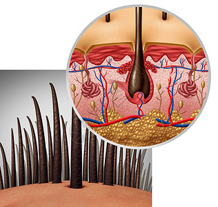 毛囊解剖图Dermitology医学人的头发与头皮出现三维插图背景