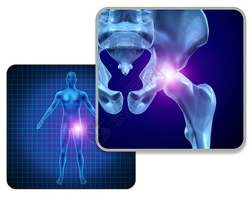 人髋关节疼痛骨骼肌肉解剖的身体与疼痛的关节疼痛的伤害关节炎疾病的象征,保健医疗症状与三维插图元素背景