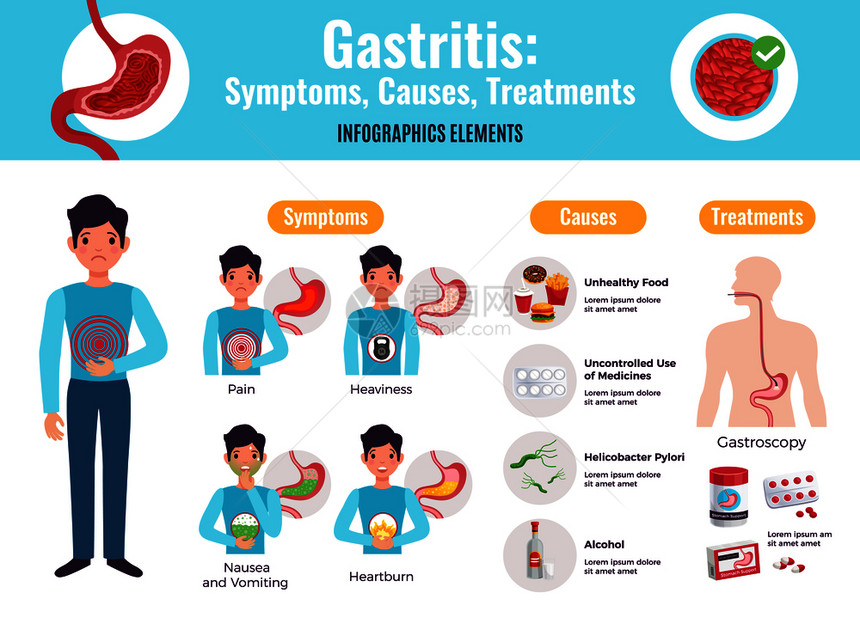 胃炎症状引治疗综合信息海报与健康食品例子胃镜手术医学平矢量插图图片