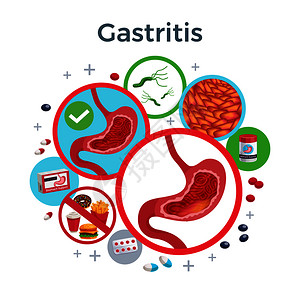 胃炎疾病症状导致药物扁平圆形成健康受影响的胃细菌食物矢量插图图片