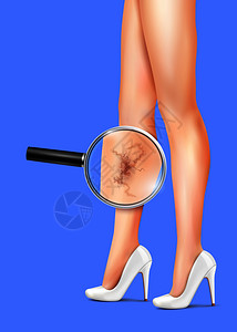 女苗条的腿静脉曲张与健康符号矢量现实插图女腿静脉曲张的现实插图背景图片