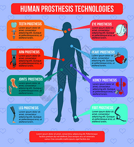 人类医学原型现代技术平信息画海报与集成植入机器人手臂人工关节矢量插图人类原型技术信息插画