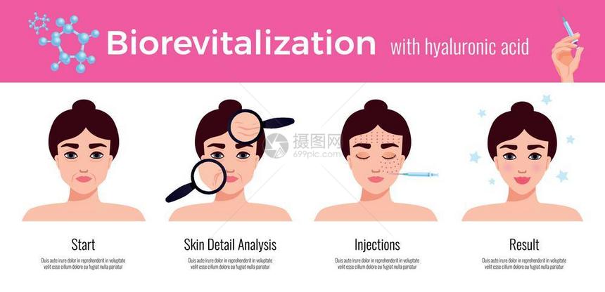 美容诊所美容效皮肤振兴治疗步骤描述与视觉结果水平平广告矢量插图图片
