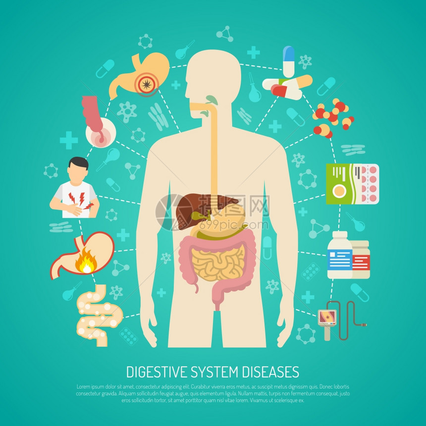 消化系统疾病插图消化系统疾病与人体绿色背景平矢量图图片