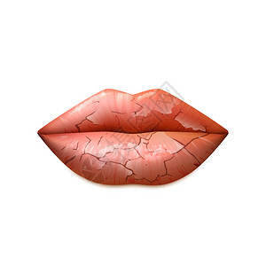 化妆品白色干嘴唇插图干裂的女人嘴唇个经典的形状,现实的孤立矢量插图插画