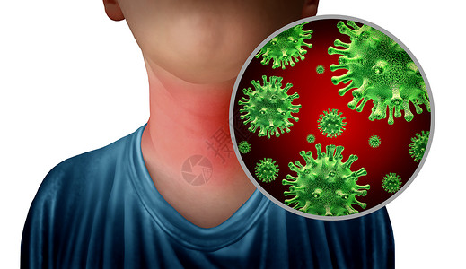 喉炎感染作为颈部有显微细菌解剖术作为流感或病的象征有3个插图图片