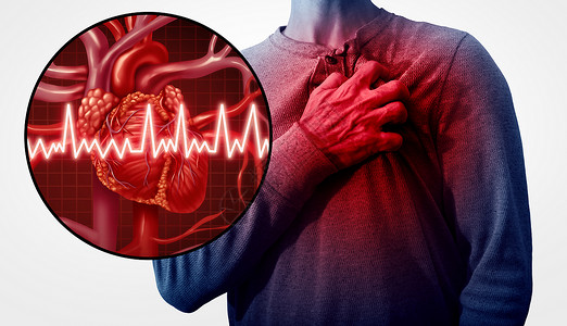 心脏病发作人类心脏病作为解剖医学疾病的概念患有心脏病者作为痛苦的冠心病带有3d插图样式元素背景