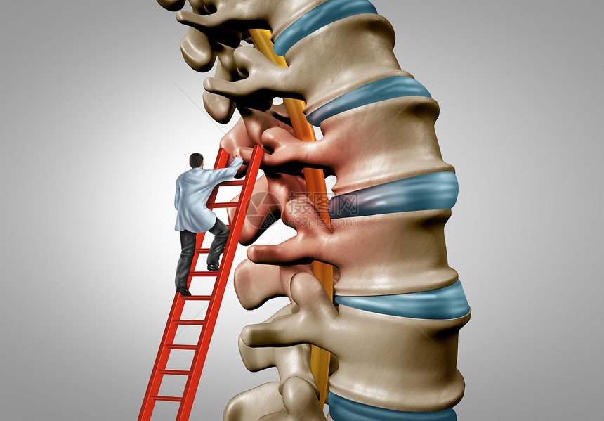 脊椎治疗和髓紧张症外科手术概念作为人类脊椎骨中一种退化疾病外科手术作为医生用3d插图元素治疗和诊断解剖图片