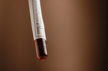 在试管中进行血检为诊断新的科罗纳感染病毒图片