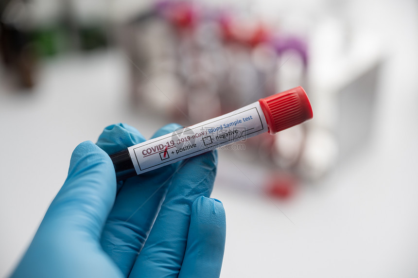 实验室技术员用血样管和板架与其他样品实验室技术员用血管样本进行化验图片