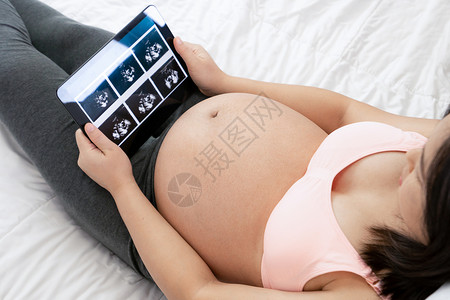 孕妇在看胎儿照图片