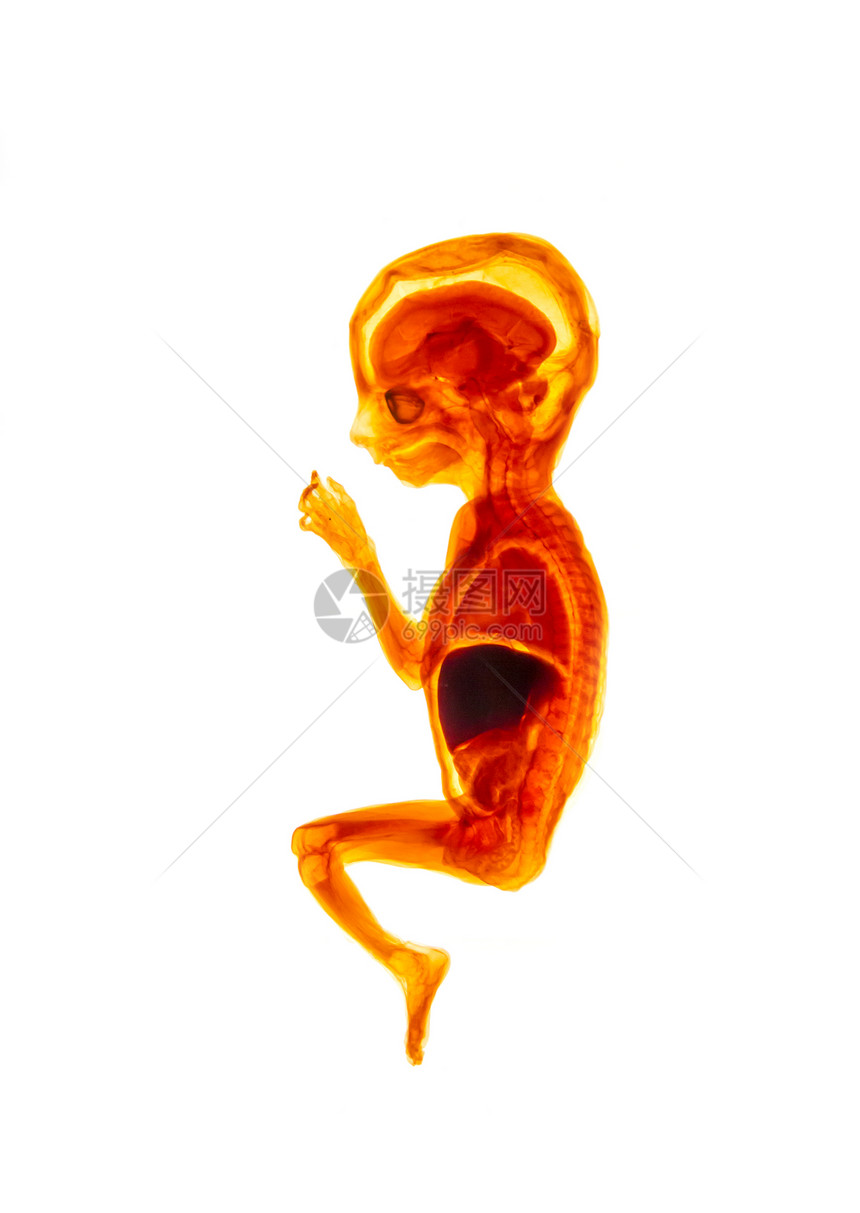 胚胎生殖产信息海报胚胎发育期怀孕医学教育人类胚胎生殖发育图片
