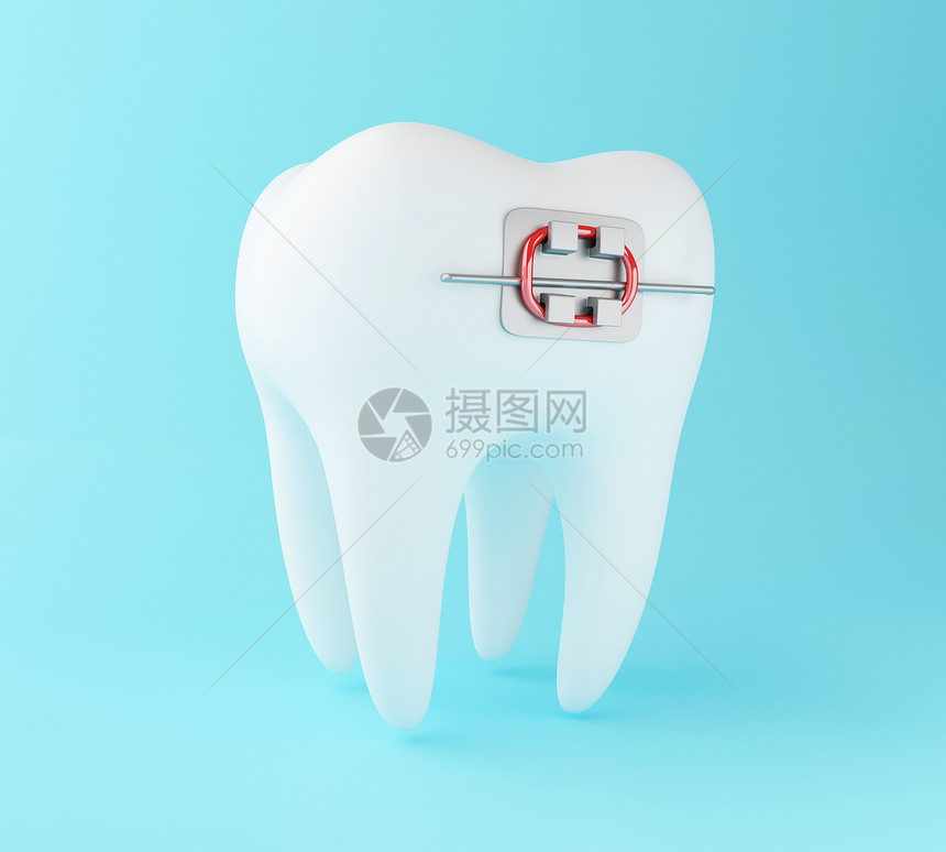 3d说明牙套科护理概念图片