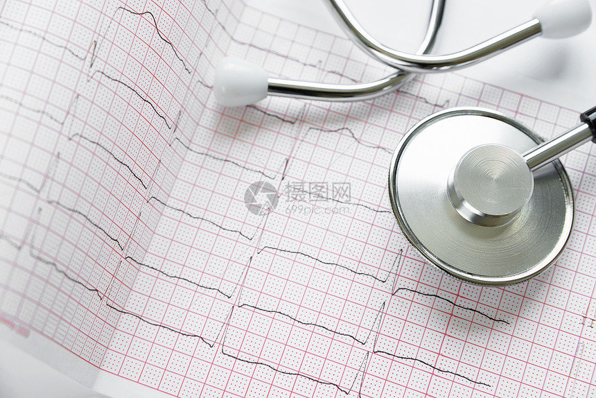 医学概念听诊镜和心血管造影在白色背景上心血管造影和听诊镜在白色图片