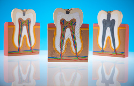 人牙结构背景图片
