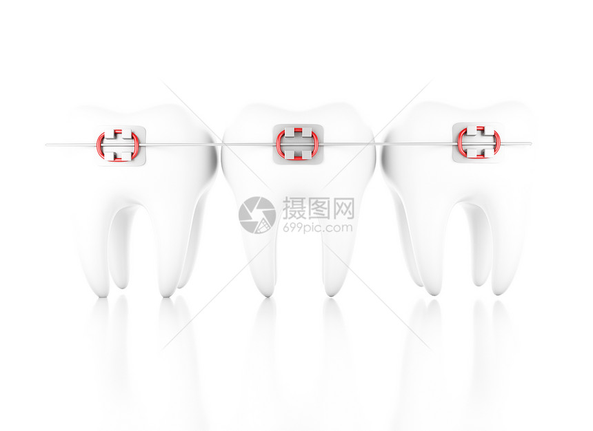 3d插图牙套科护理概念孤立的白种背景图片