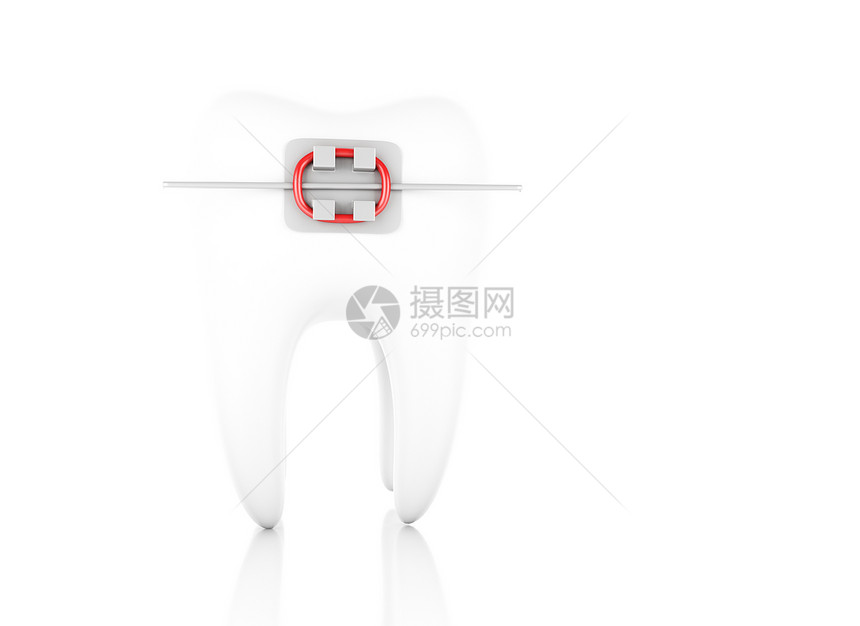 3d插图牙套科护理概念孤立的白种背景图片