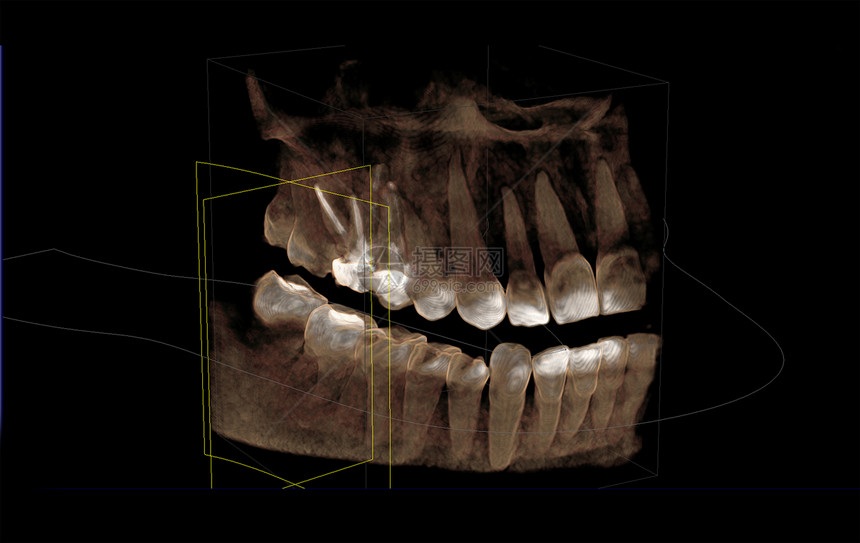 3d可视化计算机缩写图的直映图片