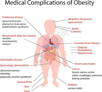 说明肥胖症医学并发图片