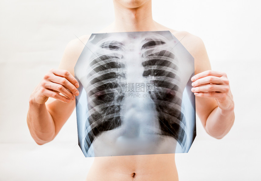 青年男子将胸口的肺部X光照射X的近距离拍摄图片
