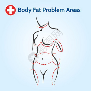 牛身体女身体脂肪问题区域女身体脂肪问题区域如线型女身体脂肪问题区域插画