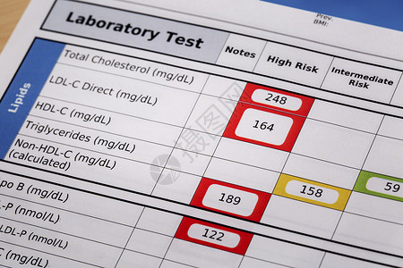 高风险胆固醇血液实验室检查结果的细节重点是脂质板图片