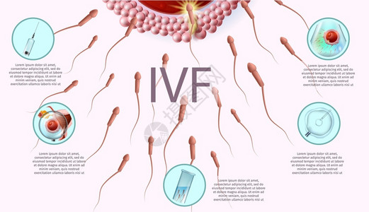 精子和卵子icsi列表图片素材