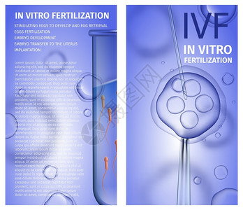 活Spermatozons的男测试管蓝渐变背景的针状女卵细胞IVF关于医疗用途的矢量现实说明背景图片