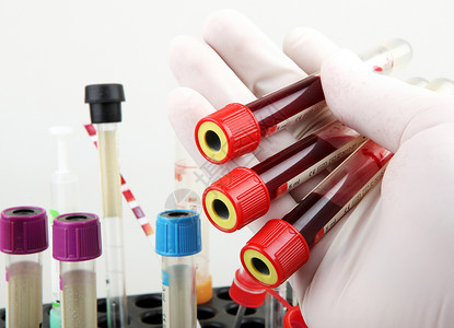 你幸福吗新冠新冠19研究血液测试定期验血是跟踪你整体身健康状况的最重要方法之一背景