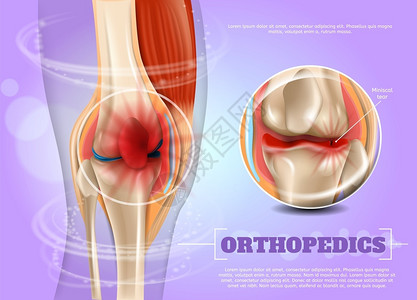膝盖疼痛3dBannerVictor图像闭合解剖和人体膝盖结构联合插画