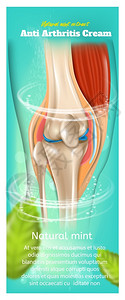 应用医疗胶合治后实际的三维矢量说明关节解剖人体膝合背景图片
