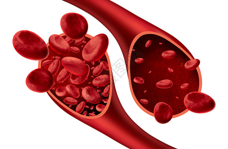 异度空间贫血和病医学图表概念是正常和异的血细胞计数动脉或血管中的人体循环是白色背景的3D插图背景