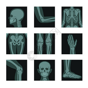 X光人体X光拍摄人体头部和手腿身体位的镜头腿和身体分的矢量肘和肋臀部膝手脚Bones或解剖骨骼系统医疗照片Skeleton和骨头X光照片插画