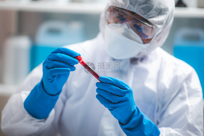 验血概念2019nCoV在医疗实验室用血管进行2019nCoV检查研究人员持有血样在医院实验室进行化图片