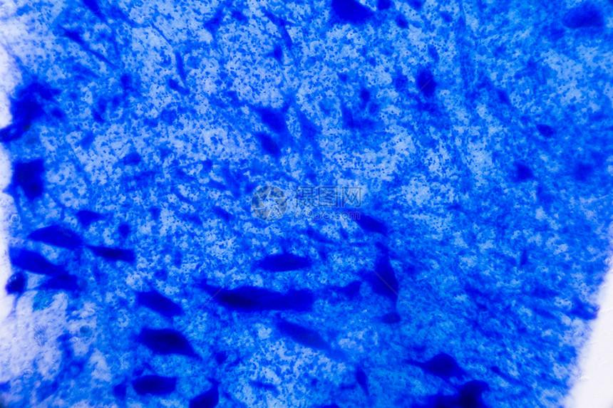 显微镜下的神经细胞白色背景上的蓝点摘要图片