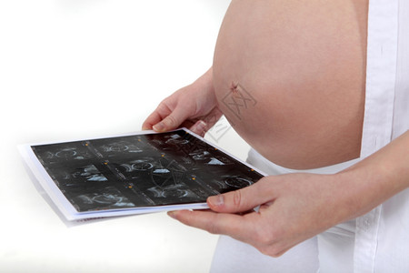 孕妇看超声波图片